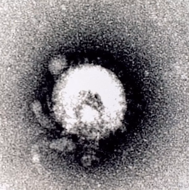 Vietnam tiene la capacidad de analizar y detectar enfermedades infecciosas emergentes como el virus H5N1, el Ébola y el nuevo Coronavirus, entre otras. En la foto: En 2004, el Instituto Nacional de Higiene y Epidemiología capturó con éxito la estructura del virus H5N1 mediante el microscopio electrónico JEM 1010. (Foto: VNA)