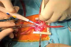 Foto de ilustración (Fuente: VNA)