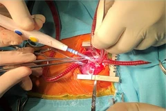 Foto de ilustración (Fuente: VNA)