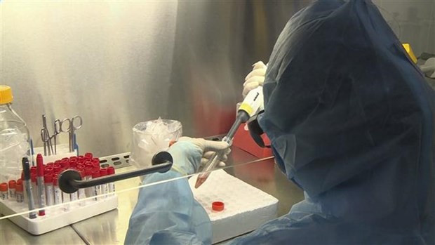 Vietnam insta al desarrollo de kits de prueba de COVID-19 para producción en masa
