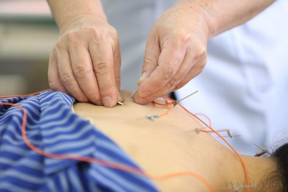 Utilizando el método de electroacupuntura para tratar a pacientes en el Hospital de Medicina Tradicional de Lang Son. (Foto: VNA)