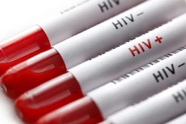 Vietnam por fomentar participación de organizaciones sociales en prevención de SIDA
