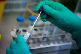 COVID-19 aún no puede considerarse una enfermedad endémica en Vietnam 