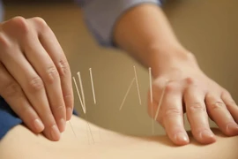 Vietnam y Japón impulsan cooperación en medicina tradicional