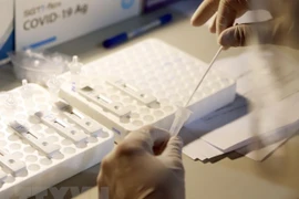 Detectan primer caso importado de Ómicron en provincia vietnamita de Binh Duong