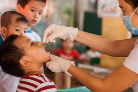 Hanoi despliega campaña de administración de suplementos de vitamina A