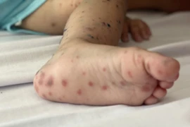 Primera vacuna contra la fiebre aftosa en espera de aprobación