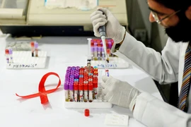Vietnam se empeña en ampliar tratamiento antirretroviral para pacientes con VIH/SIDA