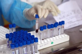 Garantizan capacidad de Vietnam de satisfacer exigencia de pruebas de coronavirus