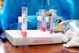 Fallece otro paciente en Vietnam por insuficiencia renal crónica y COVID-19