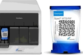 Vietnam por emplear sistema de prueba de tuberculosis en detección del coronavirus