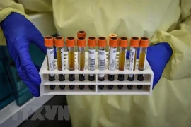 Vietnam con 51 unidades autorizadas a declarar resultados de pruebas de COVID-19