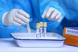 Vietnam registra cuatro casos nuevos del COVID-19
