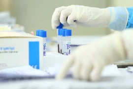 Vietnam registra 12 nuevos casos importados del COVID-19