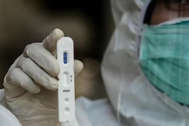 Desarrolla Tailandia kits de prueba rápida del nuevo coronavirus