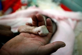 Vietnam exhorta a establecer la paz y luchar contra el hambre en Yemen