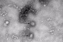 Implementan Indonesia y Corea del Sur medidas preventivas contra nuevo coronavirus