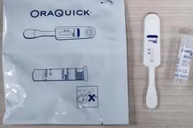 Un kit de autodiagnóstico del VIH (Foto: Ministerio de Salud de Singapur)
