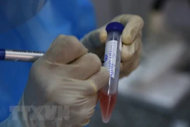 Vietnam reporta dos decesos por el COVID-19