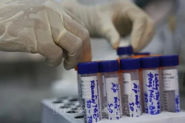 Reporta Vietnam 81 nuevos casos de COVID-19 
