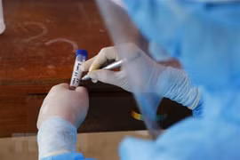 Vietnam registra disminución de casos diarios de COVID-19 