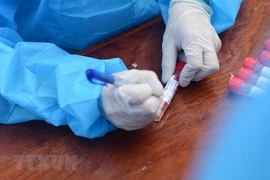 Otros 28 casos confirmados del COVID-19 en Vietnam