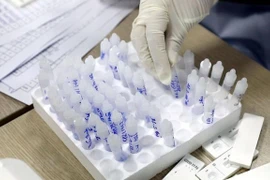 Vietnam detecta 31 nuevos casos del COVID-19