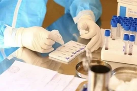 Vietnam suma 94 nuevos casos del COVID-19