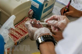 Gobierno de Laos prohíbe uso comercial de vacunas