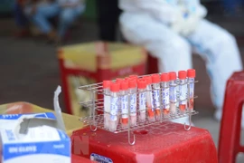 Buscan mejorar capacidad de hacer pruebas del COVID-19 en Vietnam 