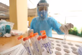 Rebasa Vietnam los 145 mil casos del COVID-19