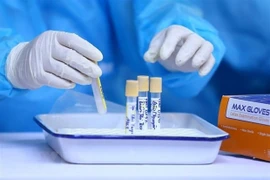 Vietnam figura entre mejores países en control del COVID-19, según instituto Lowy