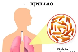 Premier de Vietnam llama a fortalecer lucha contra tuberculosis