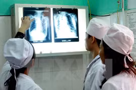 Despliegan en Vietnam programa contra brote de tuberculosis
