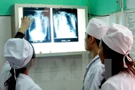Despliegan en Vietnam programa contra brote de tuberculosis