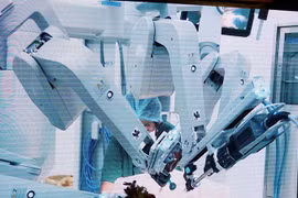 Vietnam registra tercer hospital con cirugía robótica para el cáncer