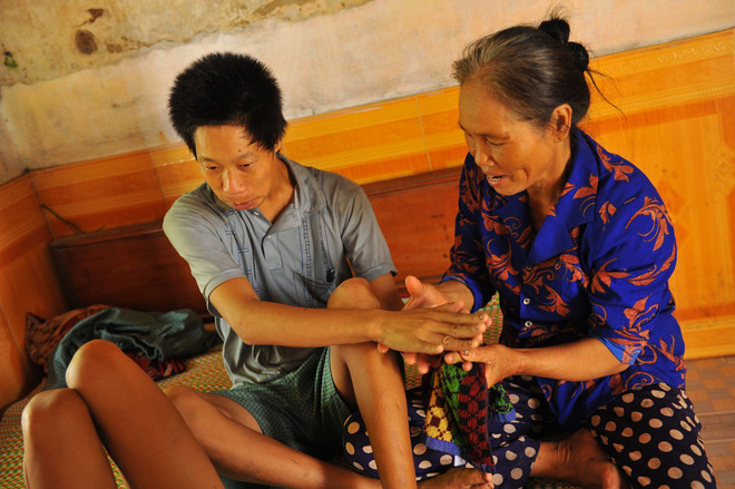 [Fotos] El dolor silencioso por dioxina en Vietnam, a 43 años del fin de la guerra ảnh 2