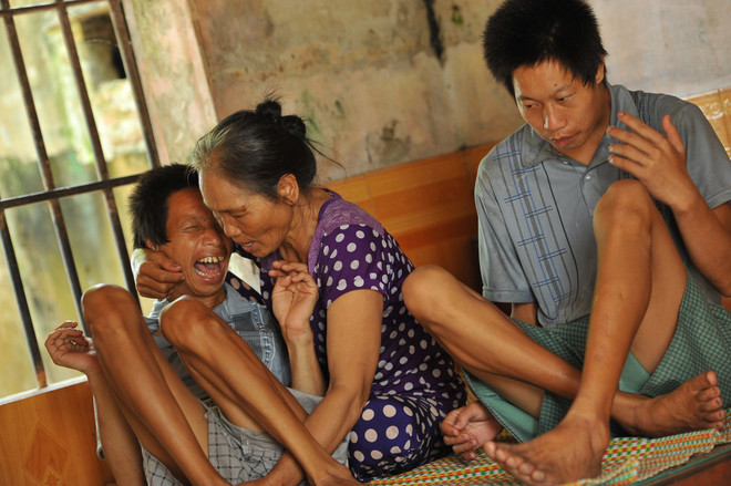 [Fotos] El dolor silencioso por dioxina en Vietnam, a 43 años del fin de la guerra ảnh 3