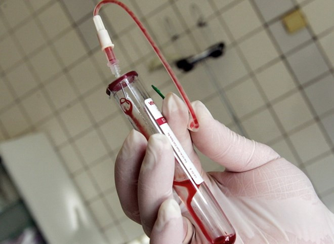 Filtran datos de más de 14 mil personas con VIH positivo en Singapur ảnh 1 Filtran datos de más de 14 mil personas con VIH positivo en Singapur ảnh 1