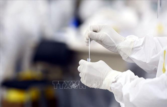 COVID-19: Vietnam reporta otros 24 contagios comunitarios ảnh 1