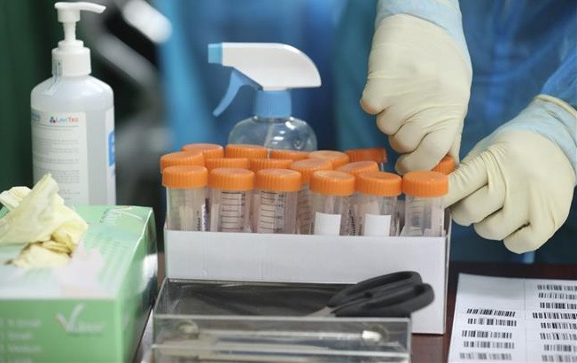 Vietnam confirma cuatro mil 802 nuevos contagios del coronavirus ảnh 1