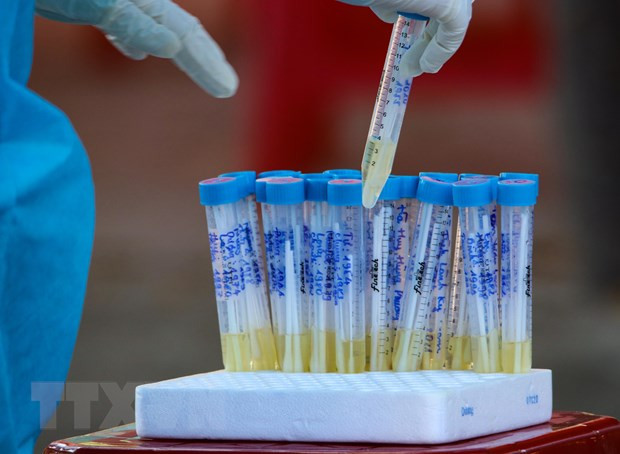 Fallecen en Vietnam otros dos casos del COVID-19 con enfermedades subyacentes graves ảnh 1 Fallecen en Vietnam otros dos casos del COVID-19 con enfermedades subyacentes graves ảnh 1