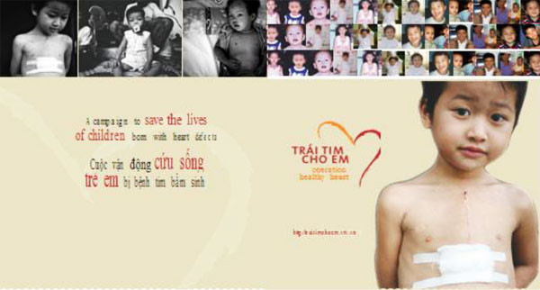 Vietnamitas en Rusia realizan programa caritativo a favor de niños con enfermedades cardíacas ảnh 1