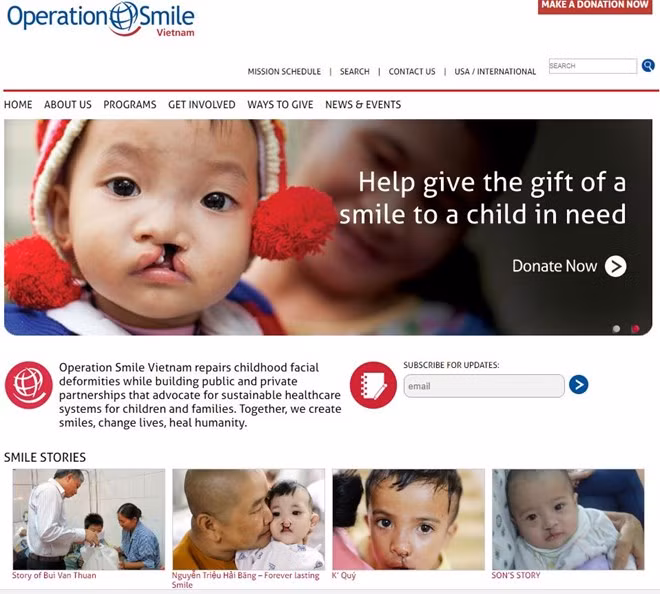 Niños vietnamitas con labio leporino se benefician de operaciones gratuitas ảnh 1