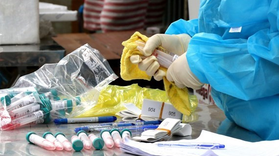 Ministro vietnamita insta a mayores esfuerzos para ganar la lucha contra COVID- 19 ảnh 1 Ministro vietnamita insta a mayores esfuerzos para ganar la lucha contra COVID- 19 ảnh 1