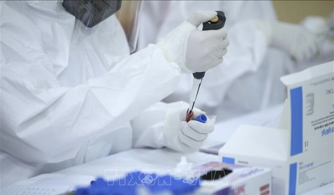 COVID-19: confirma 79 nuevos casos de transmisión local ảnh 1 COVID-19: confirma 79 nuevos casos de transmisión local ảnh 1