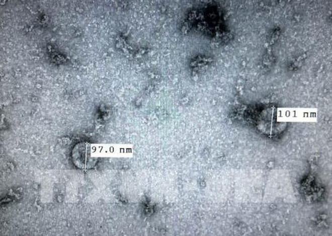 Vietnam logra recrear nuevo coronavirus en laboratorio ảnh 1 Vietnam logra recrear nuevo coronavirus en laboratorio ảnh 1