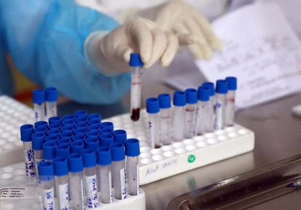 Garantizan capacidad de Vietnam de satisfacer exigencia de pruebas de coronavirus ảnh 1 Garantizan capacidad de Vietnam de satisfacer exigencia de pruebas de coronavirus ảnh 1