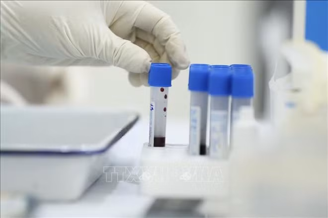 Vietnam detecta 50 nuevos contagios del COVID-19 ảnh 1