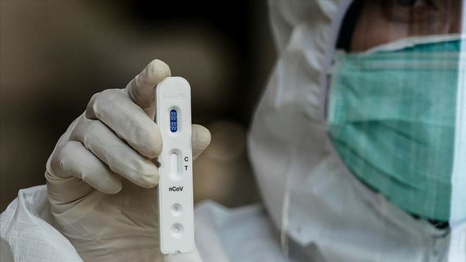 Desarrolla Tailandia kits de prueba rápida del nuevo coronavirus ảnh 1 Desarrolla Tailandia kits de prueba rápida del nuevo coronavirus ảnh 1